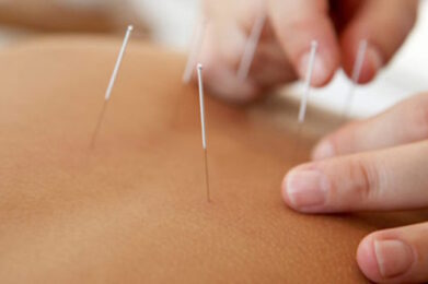 Needles