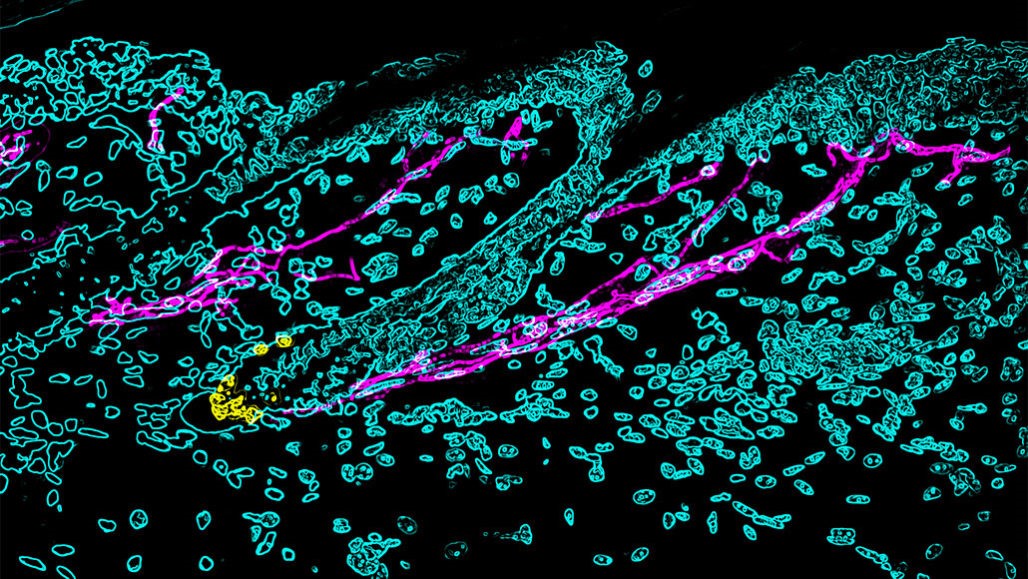 Stress turns hair gray by triggering the body’s fight-or-flight response